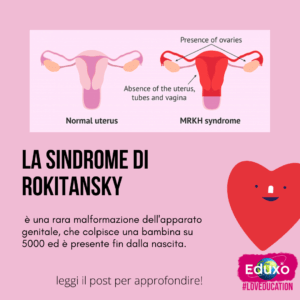 Read more about the article La Sindrome di Rokitansky